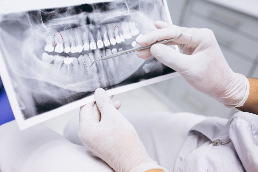 Factorii de risc care duc la declanșarea bolilor parodontale