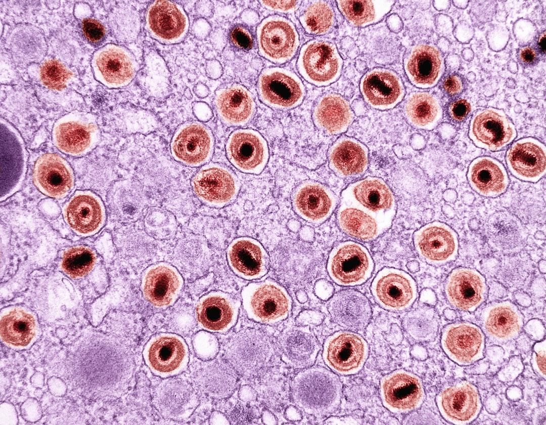 Photo parkinson disease