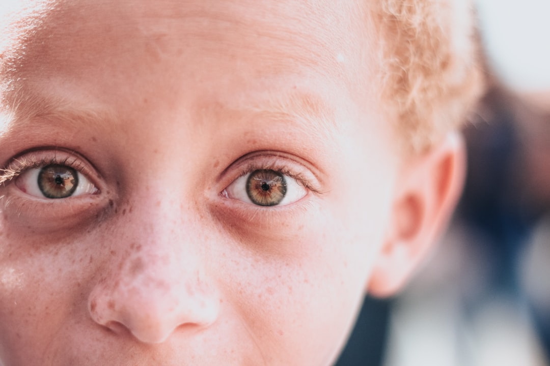 Photo skin conditions