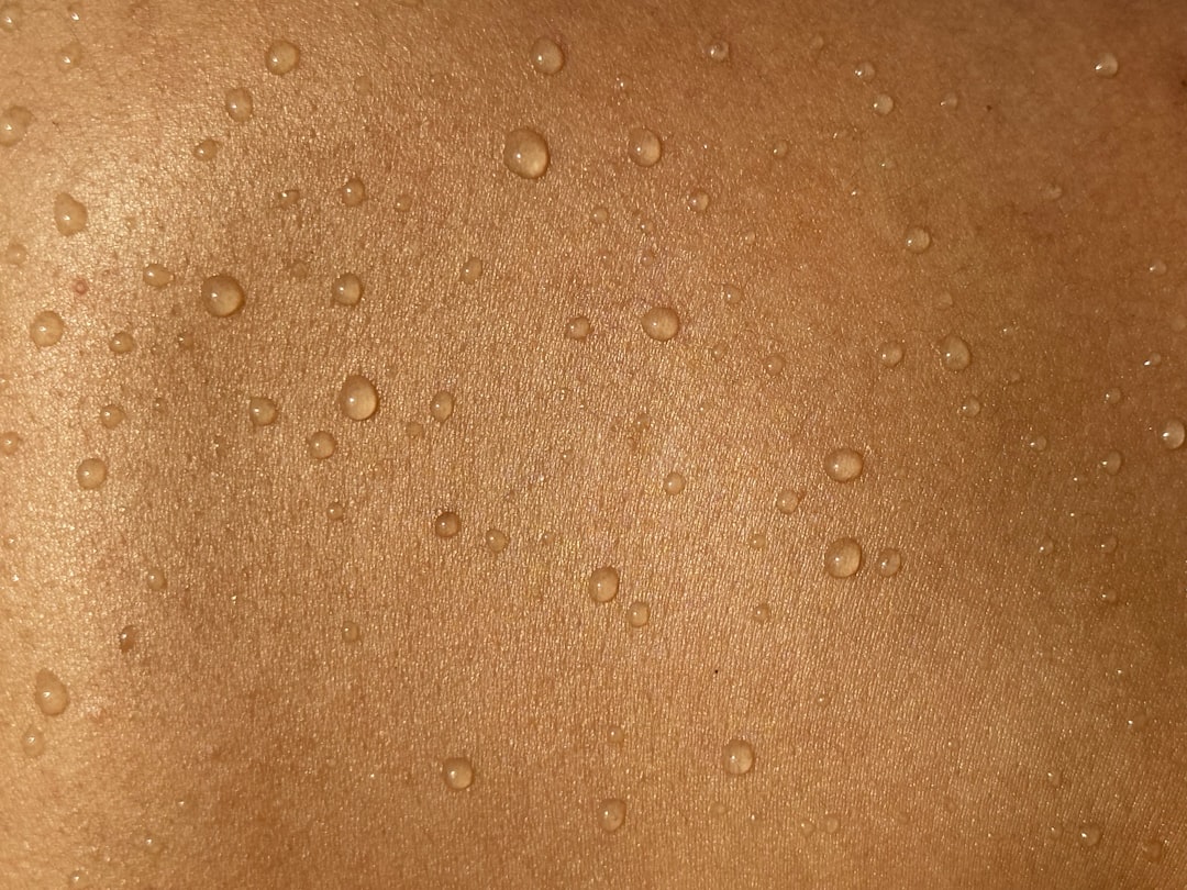 Photo dermatitis