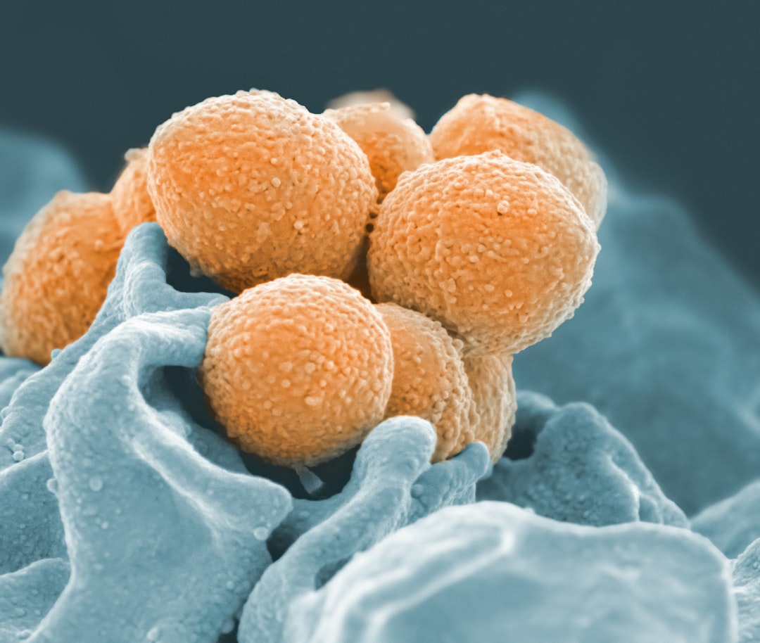 Photo genital infections