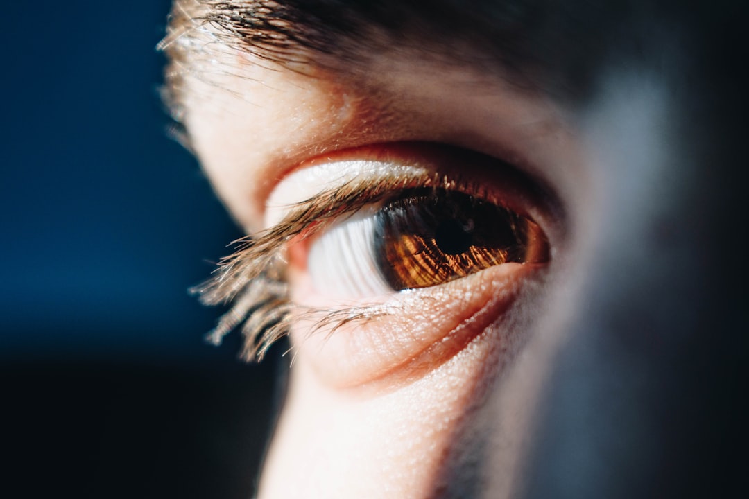 Photo protecting vision