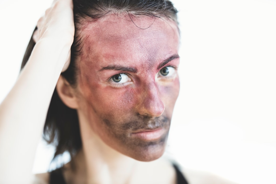 Photo dermatological conditions