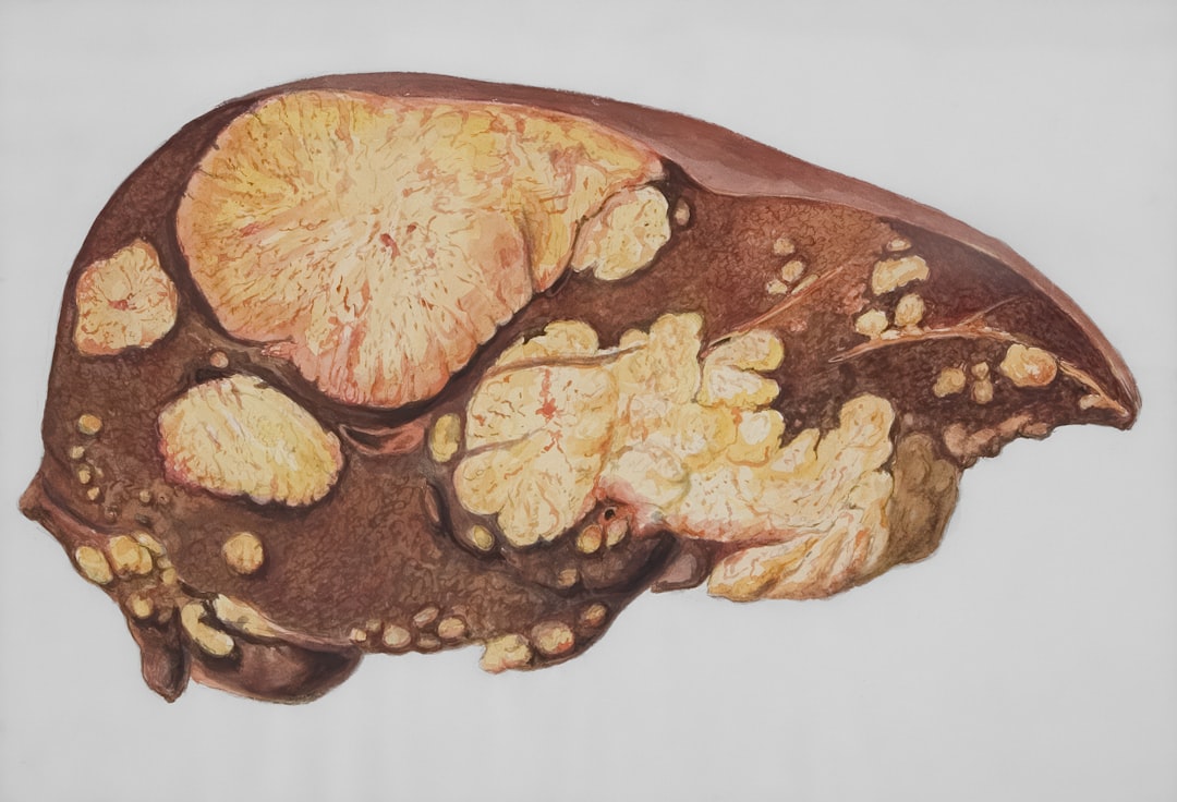 Photo cirrhosis