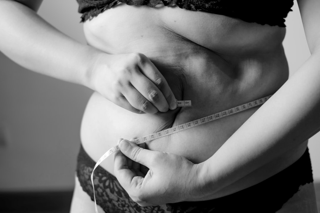 Photo obesity