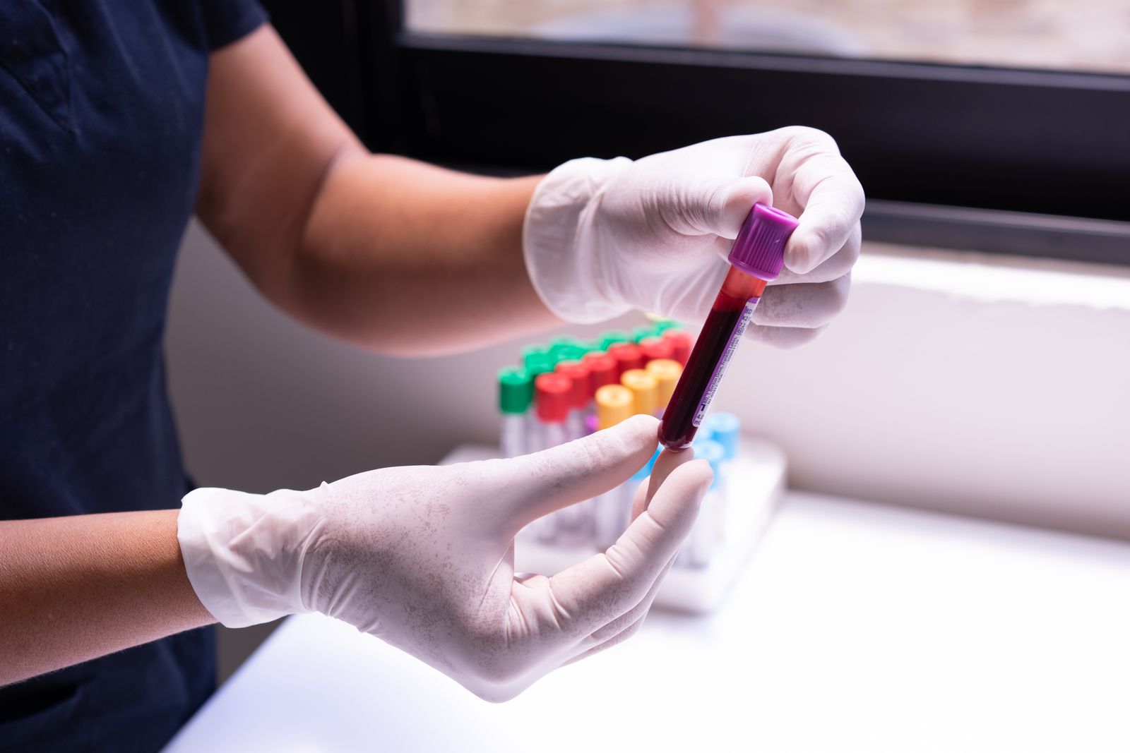 Synevo si rolul analizelor de laborator in monitorizarea san — Clinica Online