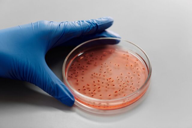 Placă Petri cu culturi bacteriene într-un laborator de microbiologie, folosită pentru testarea antibioticelor